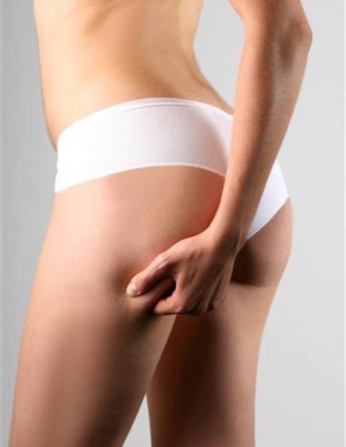 Objectifs esthétiques ciblés sur le fessier